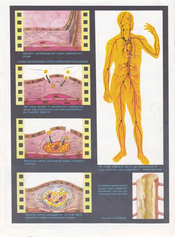  Журнал «Здоровье» - Здоровье 1985 №08 - Страница № 22