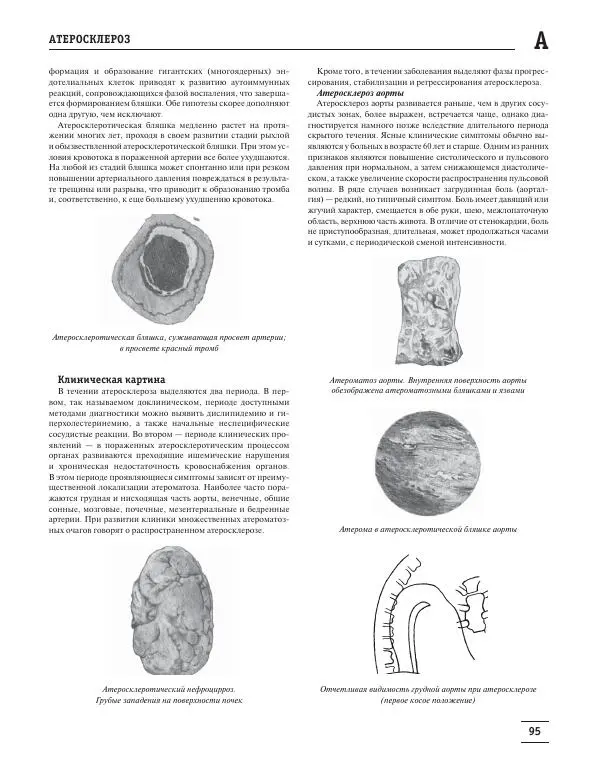 Юрий Елисеев - Большая медицинская энциклопедия - Страница № 96